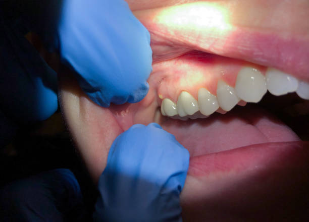 Best Emergency Gum Treatment in Shrewsbury, PA